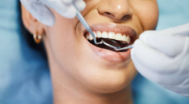 Best Emergency Denture Repair in Gilroy, CA
