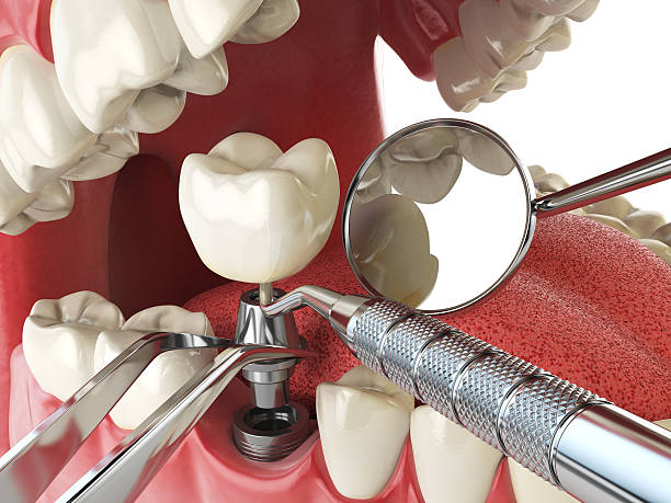 Best Walk-In Emergency Dental Services in Gilroy, CA